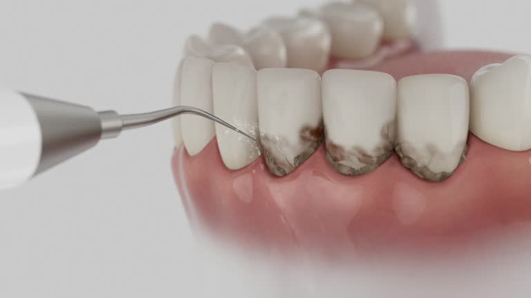 Trusted Teeth Cleaning And Checkup service in Due West, SC - Dentist Open Now